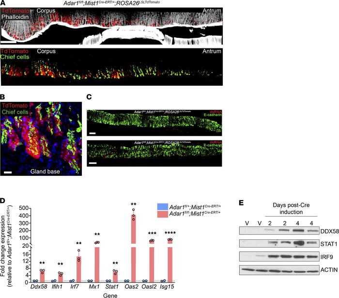 Deletion of Adar1 from gastric chief cells results in the accumulation o...