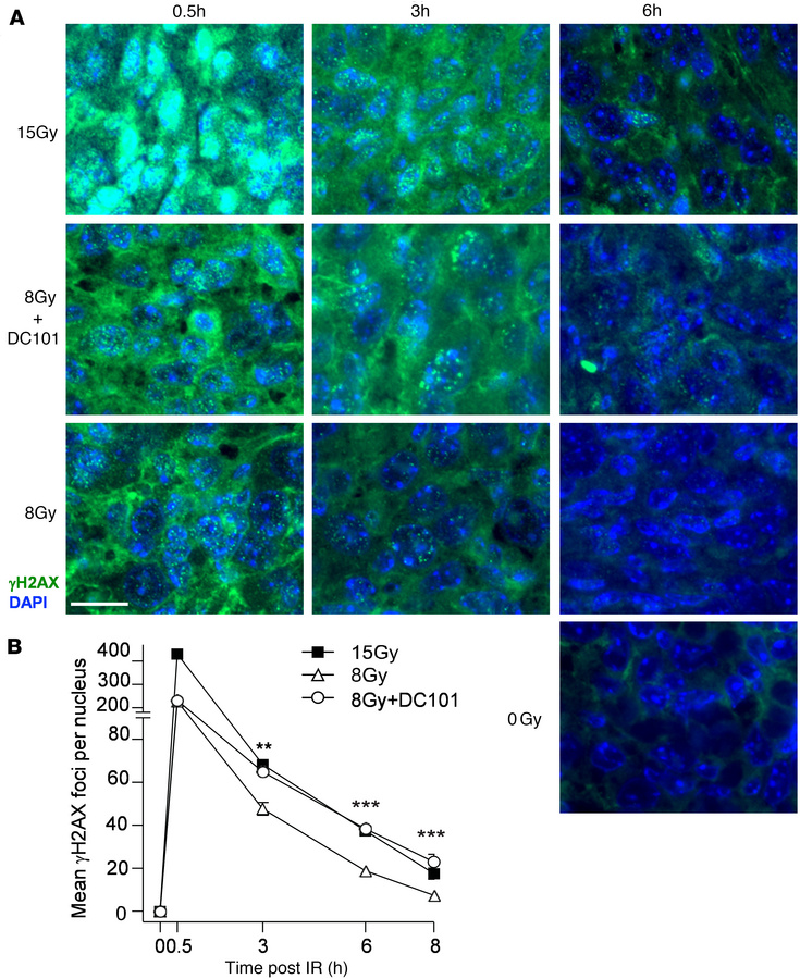 Delivery of the VEGFR2 inhibitor DC101 at 1 hour preceding SDRT attenuat...