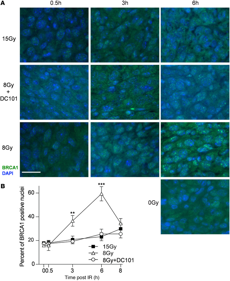 Delivery of the VEGFR2 inhibitor DC101 at 1 hour preceding SDRT prevents...