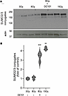 Delivery of the VEGFR2 inhibitor DC101 at 1 hour preceding SDRT sensitizes