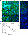 Delivery of the VEGFR2 inhibitor DC101 at 1 hour preceding SDRT attenuates