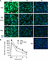 Delivery of the VEGFR2 inhibitor DC101 at 1 hour preceding SDRT attenuates