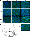 Delivery of the VEGFR2 inhibitor DC101 at 1 hour preceding SDRT prevents lo