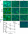 Delivery of the VEGFR2 inhibitor DC101 at 1 hour preceding SDRT does not af