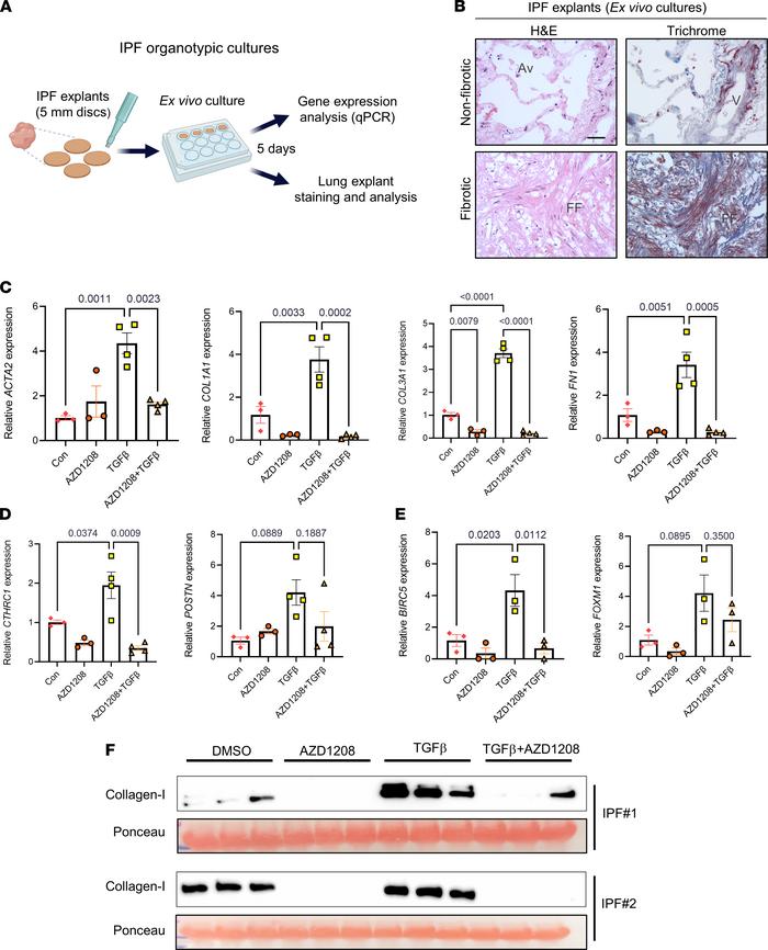 PIM1 inhibition inhibits profibrotic gene expression and collagen secret...