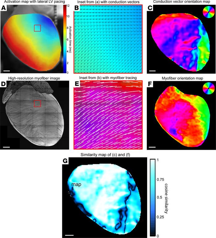 Structure-function alignment correlates global ventricular impulse propa...