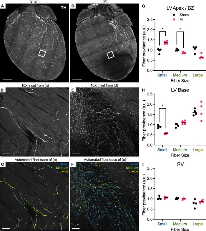Altered distribution of neuroeffector endings after myocardial infarctio...