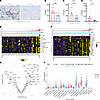Altered immune TME in TEXhi breast tumors.