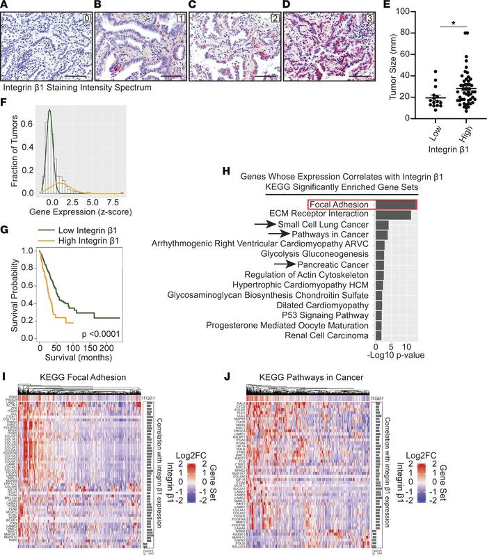 Increased integrin β1 protein and gene expression correlates with increa...