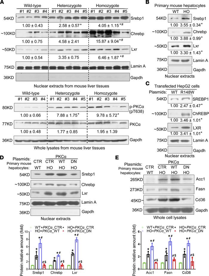 The Sema7aR145W mutation enhances hepatic FA and TG synthesis and FA upt...