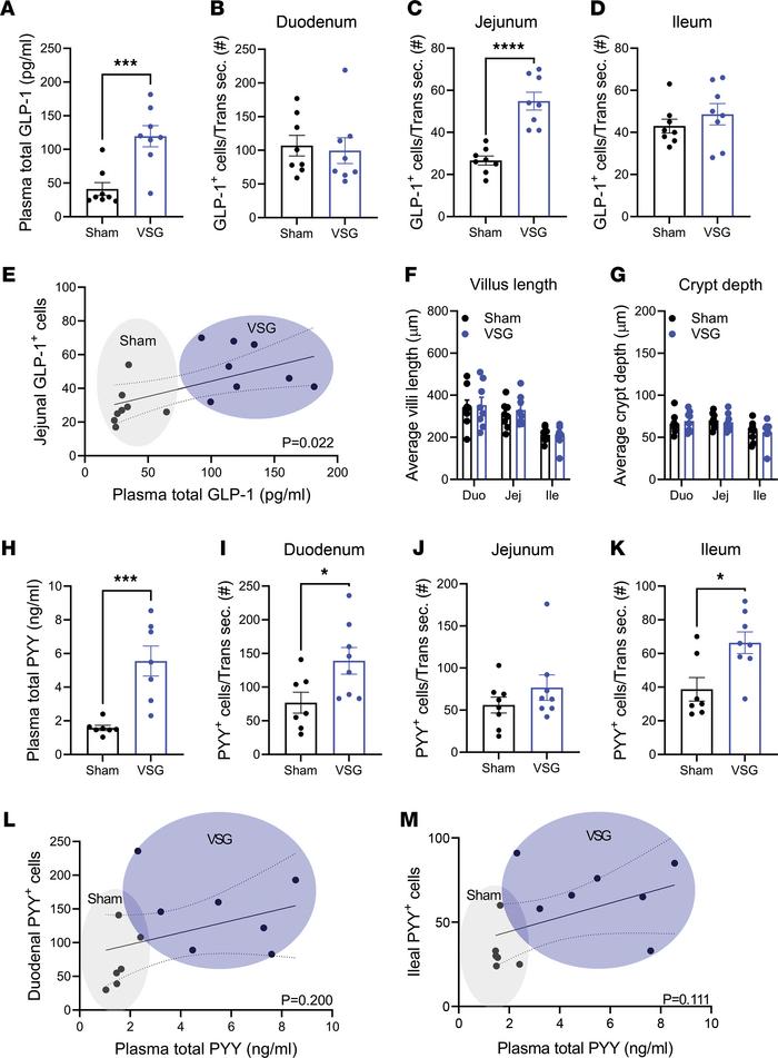 VSG increases plasma levels and EEC number of GLP-1 and PYY.
(A) Plasma ...