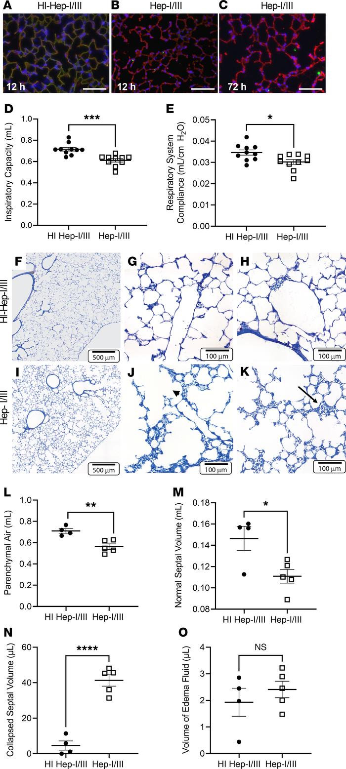 Alveolar epithelial glycocalyx degradation impairs lung compliance by ca...
