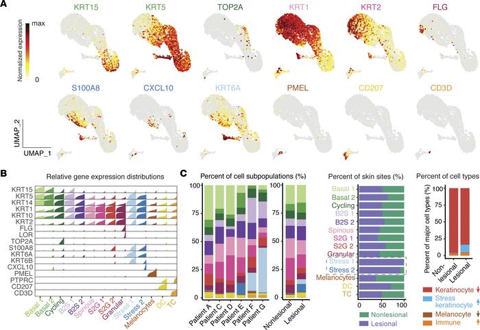 scRNA-Seq analyses of lesional and nonlesional skin reveal unique kerati...