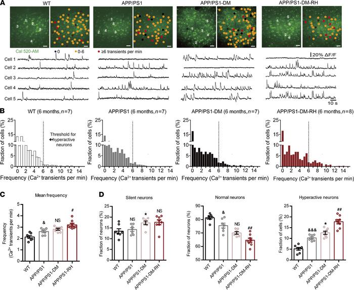 Neuronal hyperactivity in APP/PS1-DM mice was significantly increased by...