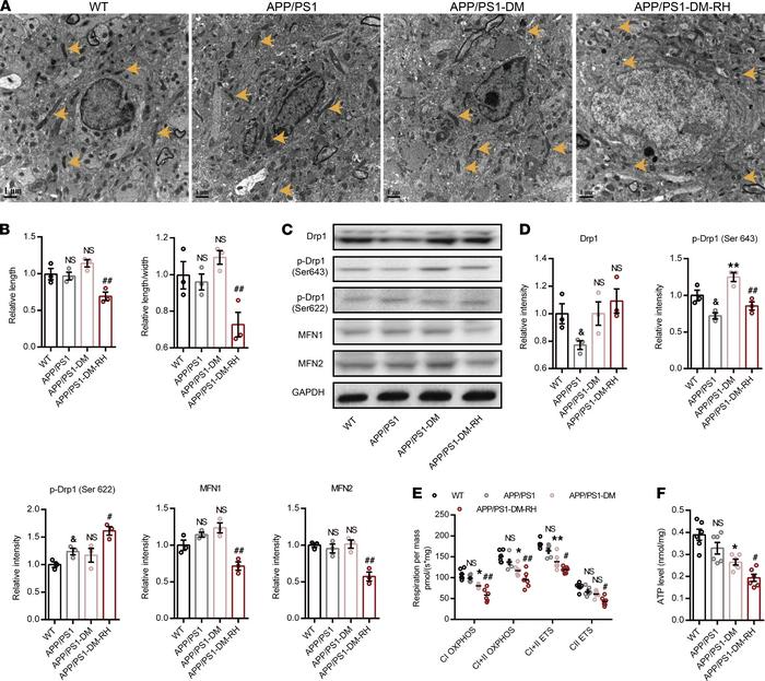 RH exacerbates brain mitochondrial dysfunction and energy stress in STZ-...