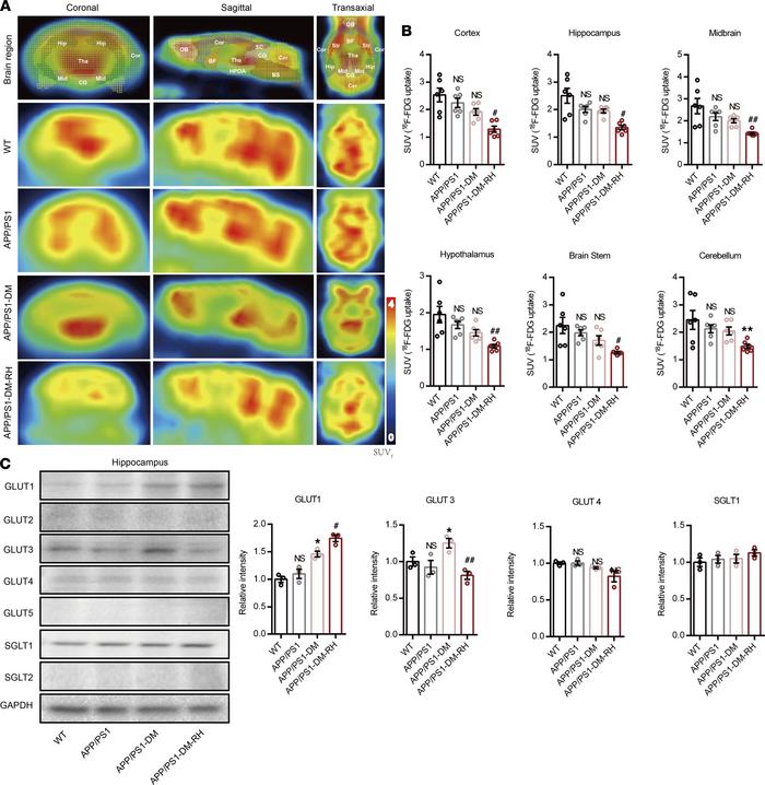 RH reduced brain GLUT3-mediated glucose uptake in STZ-induced APP/PS1-DM...