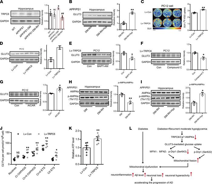TRPC6 regulates GLUT3-mediated glucose uptake and mitochondrial function...