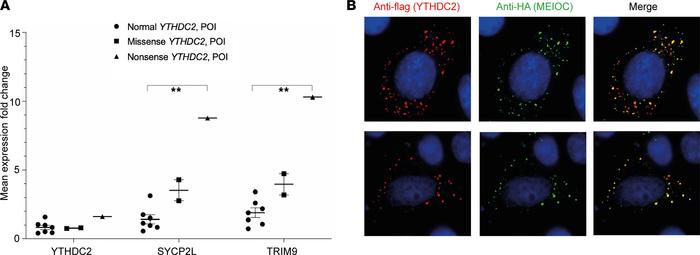YTHDC2 expression and stability in peripheral leukocytes of patients wit...