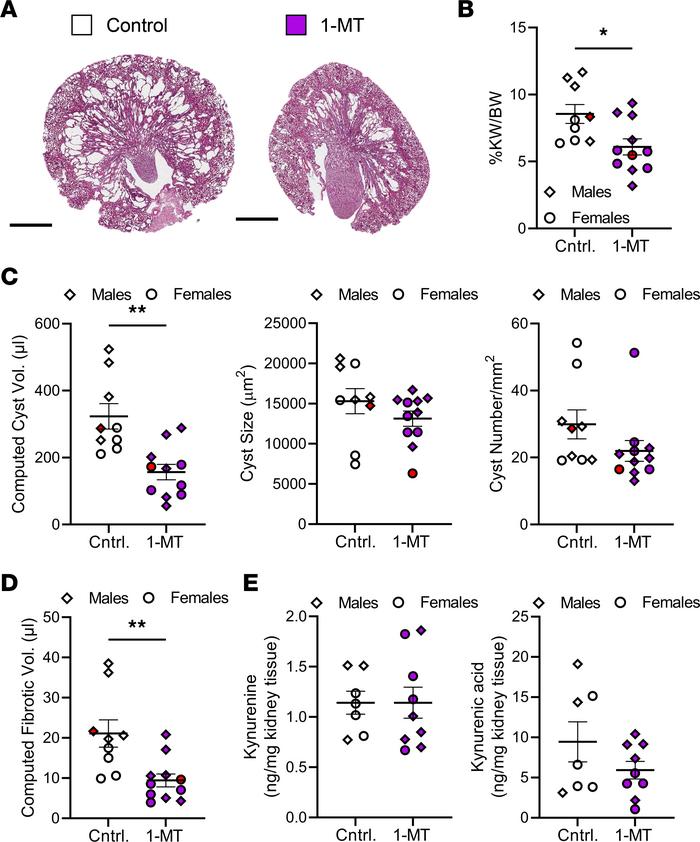 1-MT treatment slows PKD progression in a rapidly progressive, inducible...