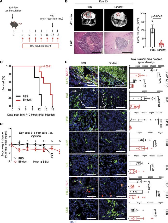 MCP-1 inhibition delays B16-F10 MBM progression.
(A) B16-F10 melanoma ce...