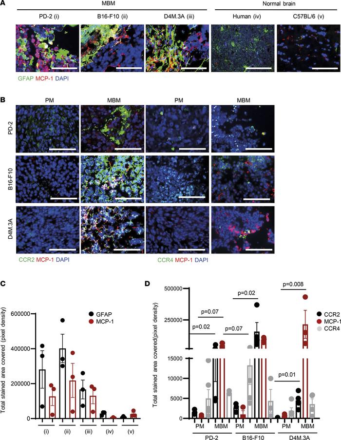 Astrocytes’ activation and MCP-1 secretion may trigger CCR2/CCR4 overexp...