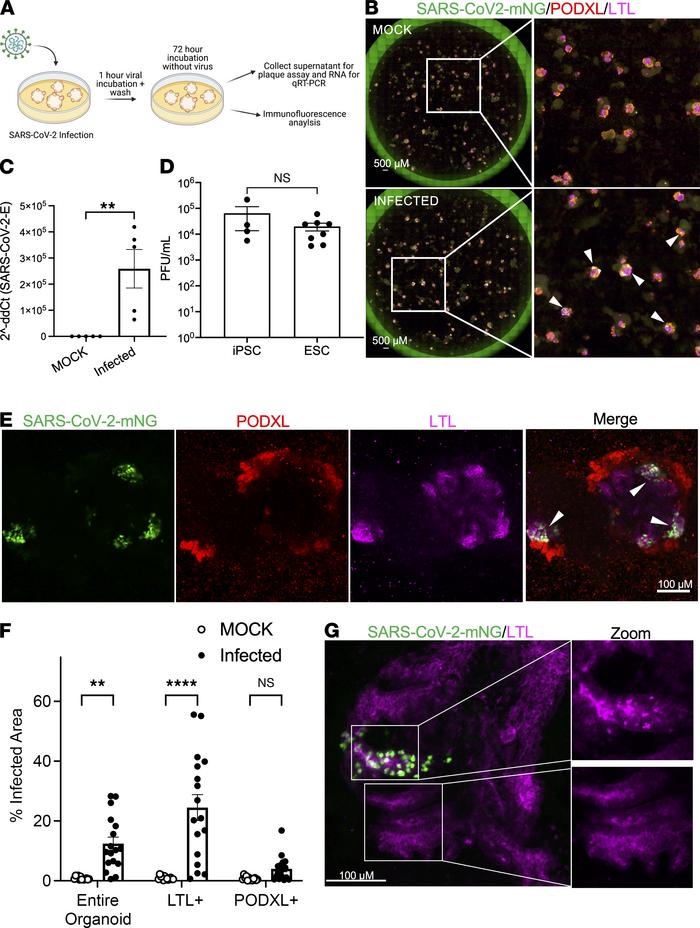 SARS-CoV-2 efficiently infects human kidney organoids with tropism for p...