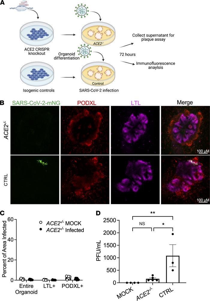 ACE2 is an essential viral entry pathway for SARS-CoV-2 infection of kid...
