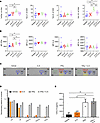 Combined blockade of IL-6 and CTLA-4 promotes IFN-γ production by CD4 T cel