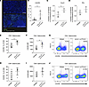 CXCR3+ T cells in PDAC tumors following dual IL-6/CTLA-4 blockade.