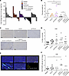 Dual IL-6/CTLA-4 blockade controls murine orthotopic pancreatic tumors in a