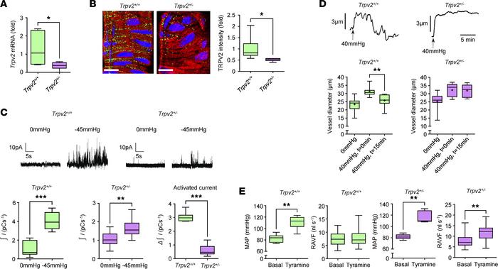 Impaired retinal myogenic signalling and blood flow autoregulation in TR...