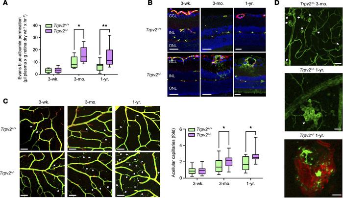 Retinal vascular defects in TRPV2 heterozygous rats.
(A) Retinal Evans b...