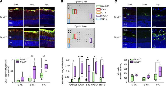 Glial and inflammatory changes in TRPV2 heterozygous retinas.
(A) Top, r...