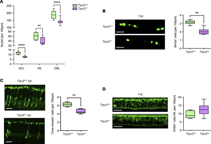 Retinal neurodegenerative changes in TRPV2 heterozygous rats.
(A) Box-an...