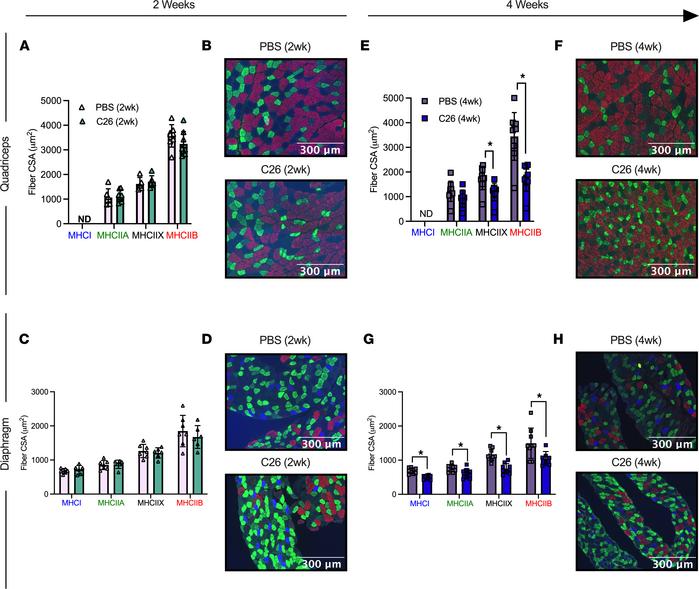 Evaluation of quadriceps and diaphragm fiber type atrophy in skeletal mu...