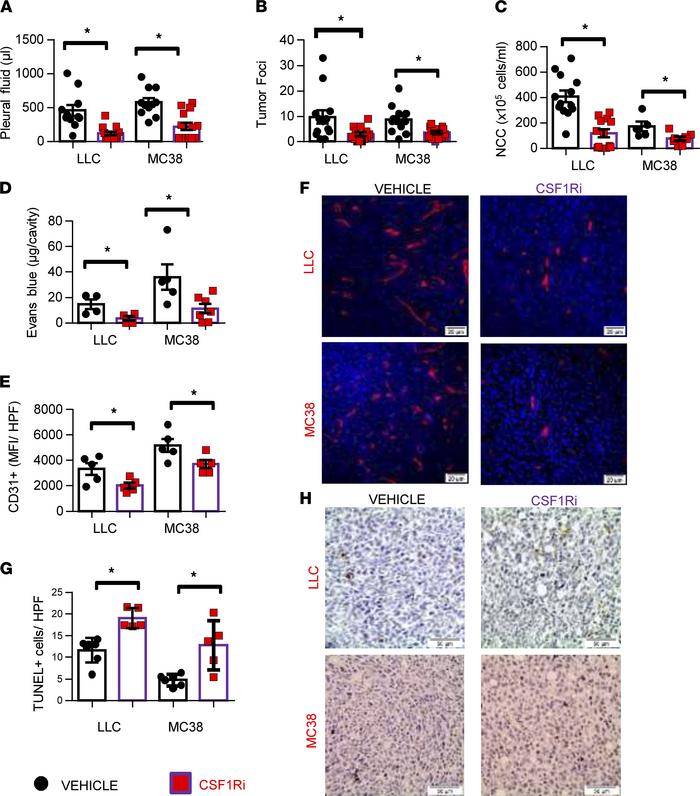 Pharmacological targeting of CSF1R abrogates MPE formation.
C57BL/6 mice...