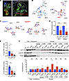 ELF4 functional changes induced by p.T187N.
