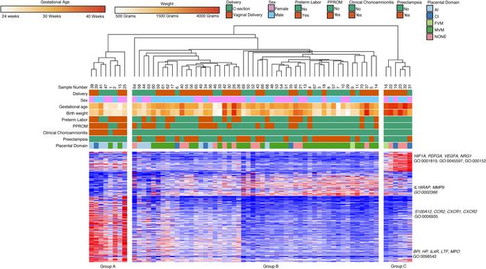 Intermediate monocyte gene expression clusters by GA, clinical phenotype...