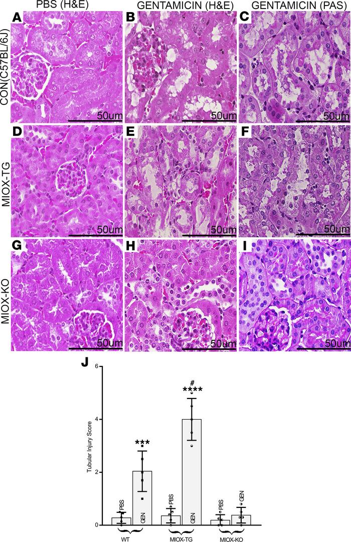Accentuation of gentamicin induced acute tubular injury following MIOX o...