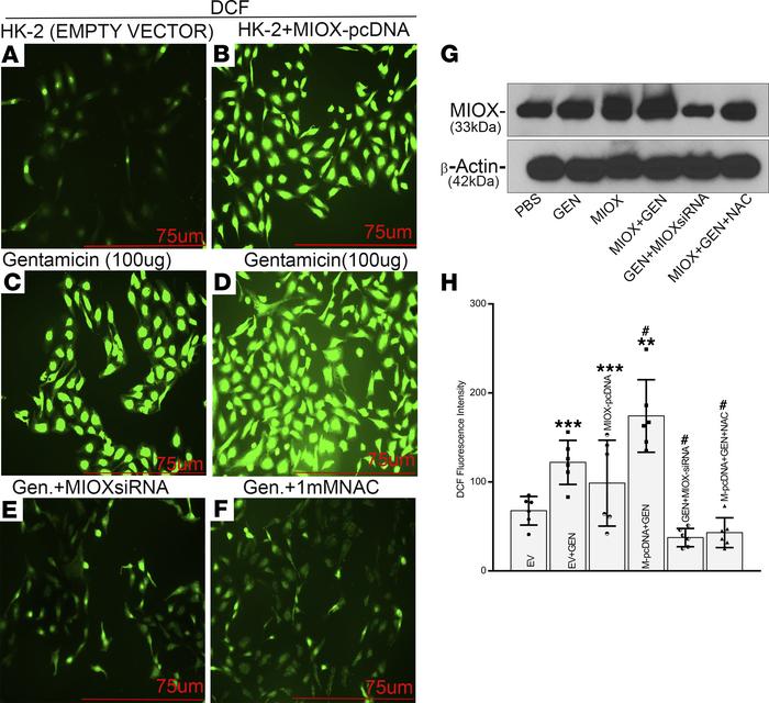 Augmentation of gentamicin-induced oxidant stress by MIOX overexpression...