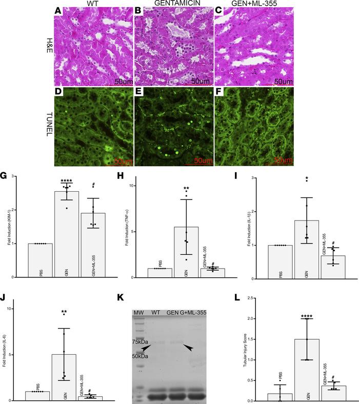 Blocking of 12-HETE restores cellular integrity, expression of inflammat...