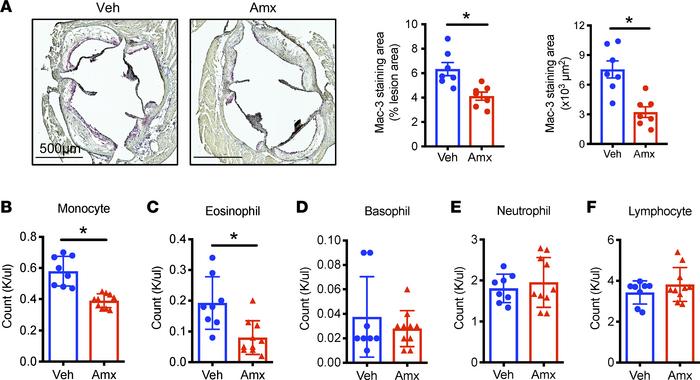 Amlexanox reduces circulating monocytes and lesion macrophages.
Ldlr–/– ...