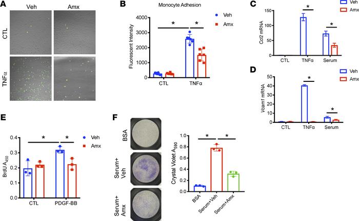 Amlexanox prevents dysfunction of aortic vessel cells.
(A and B) THP-1 m...