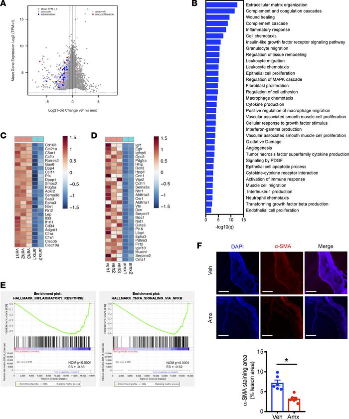 Amlexanox affects aortic transcriptome during atherogenesis.
(A–E) Trans...