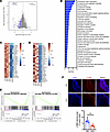 Amlexanox affects aortic transcriptome during atherogenesis.
