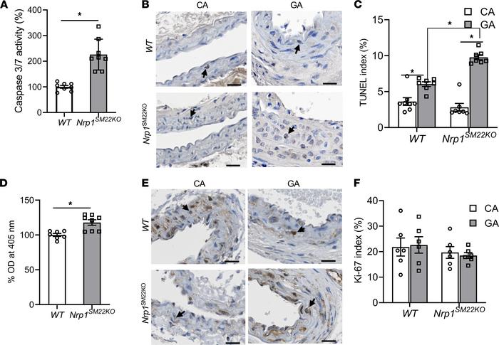 Smooth muscle cell Nrp1 deletion causes an increase in apoptosis of smoo...