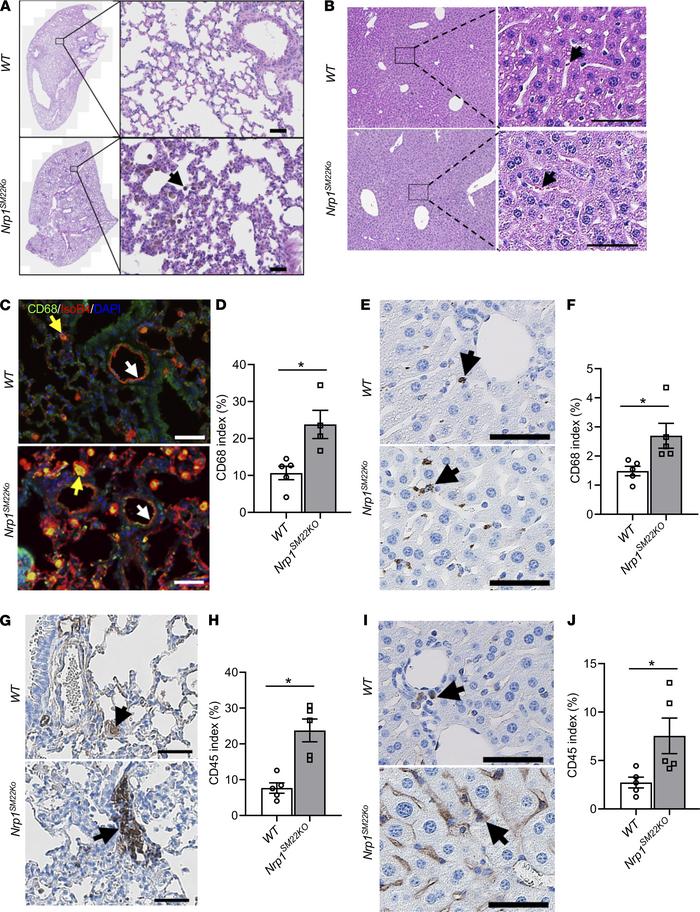 Augmented immune cell infiltration in lung and liver of Nrp1SM22KO mice....