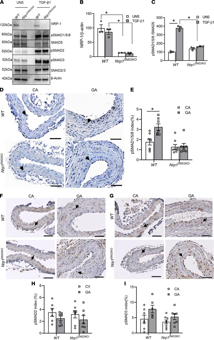 
Nrp1 deletion in smooth muscle cells results in a reduction of TGF-β1–p...