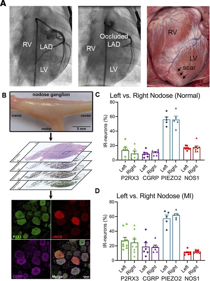 Assessment of expression profiles of left versus right nodose ganglia ne...