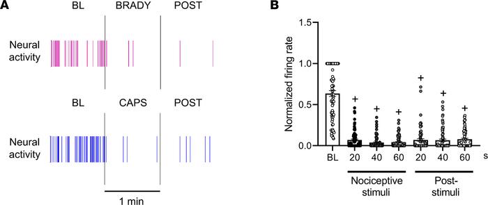 Temporal profile of nociceptive neural responses in infarcted animals de...